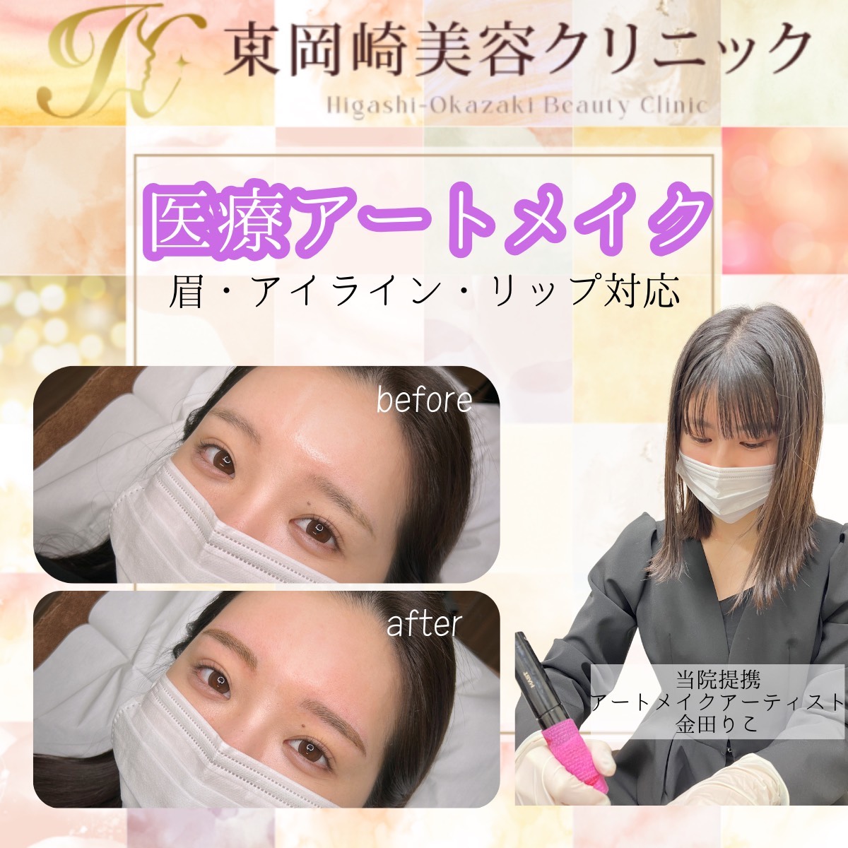 医療アートメイク
