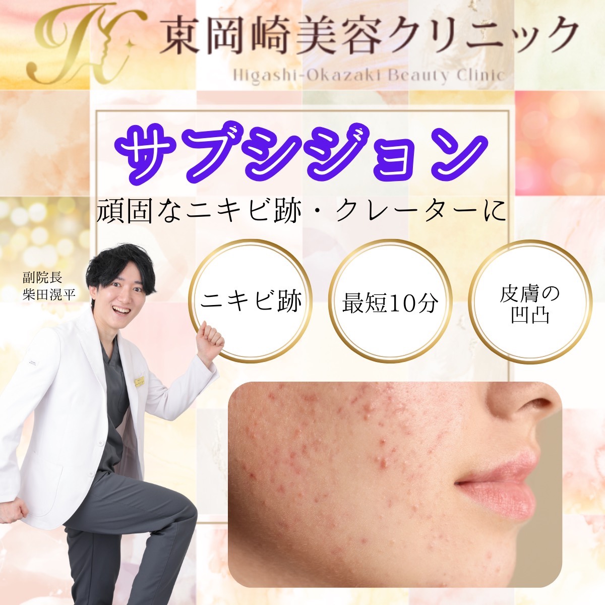 サブシジョン