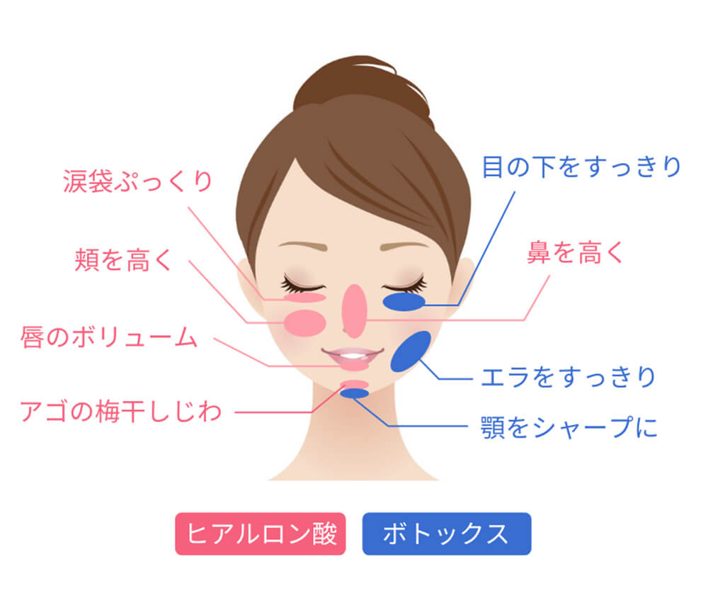 東岡崎美容クリニックでヒアルロン酸・ボトックス治療が受けられる部位