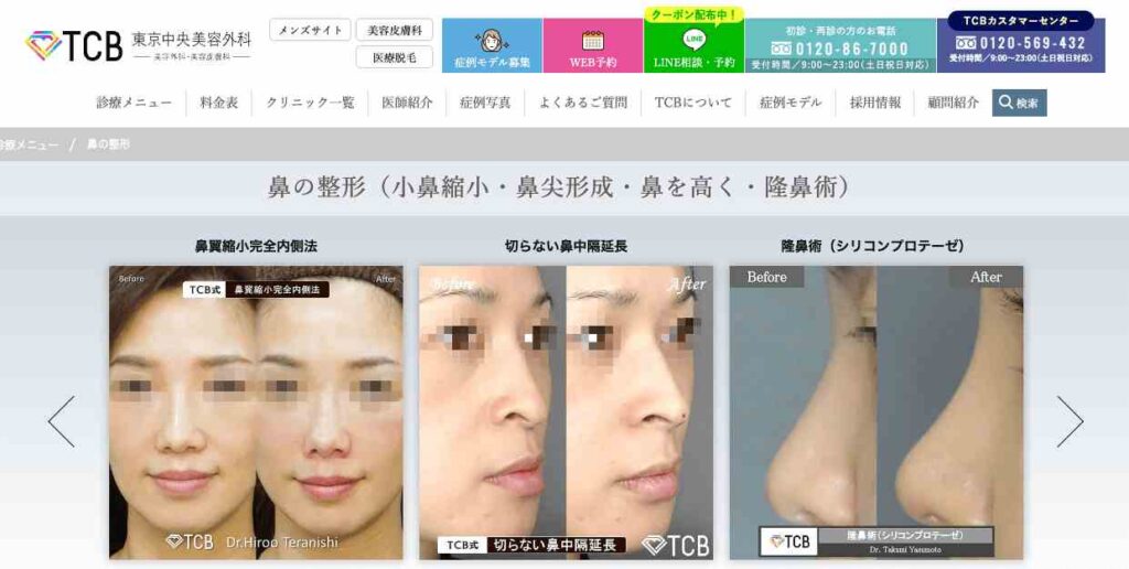 TCB東京中央美容外科-鼻整形FV