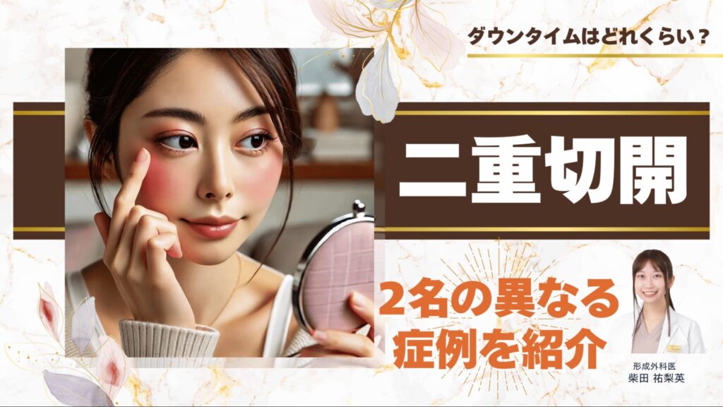 二重切開ダウンタイムはどれくらい？2名の異なる症例で短くするポイントや経過を紹介 アイキャッチ