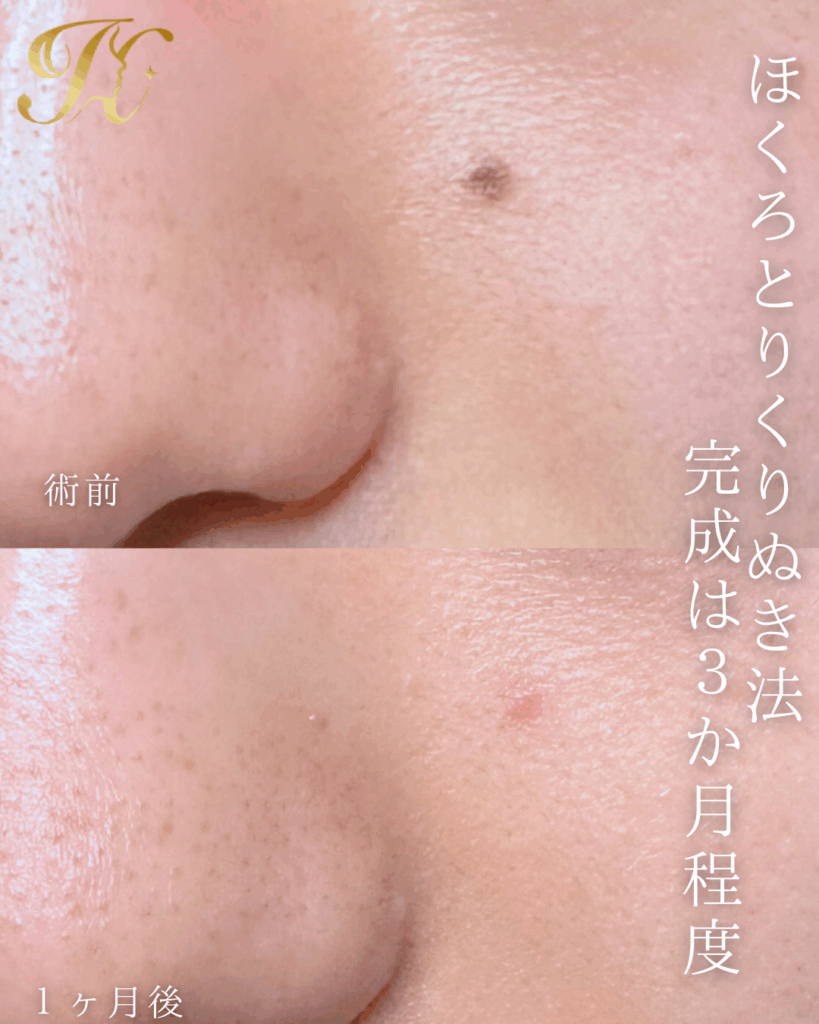症例イメージ