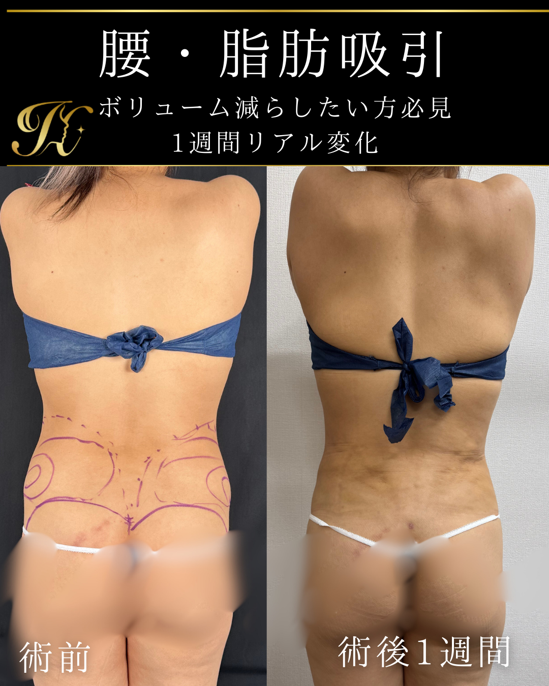 症例イメージ