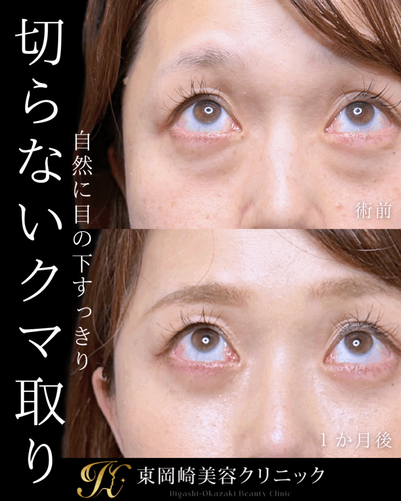症例イメージ