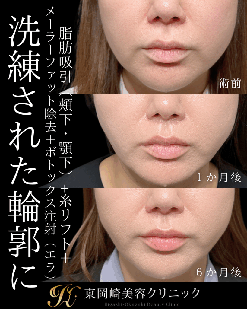 症例イメージ