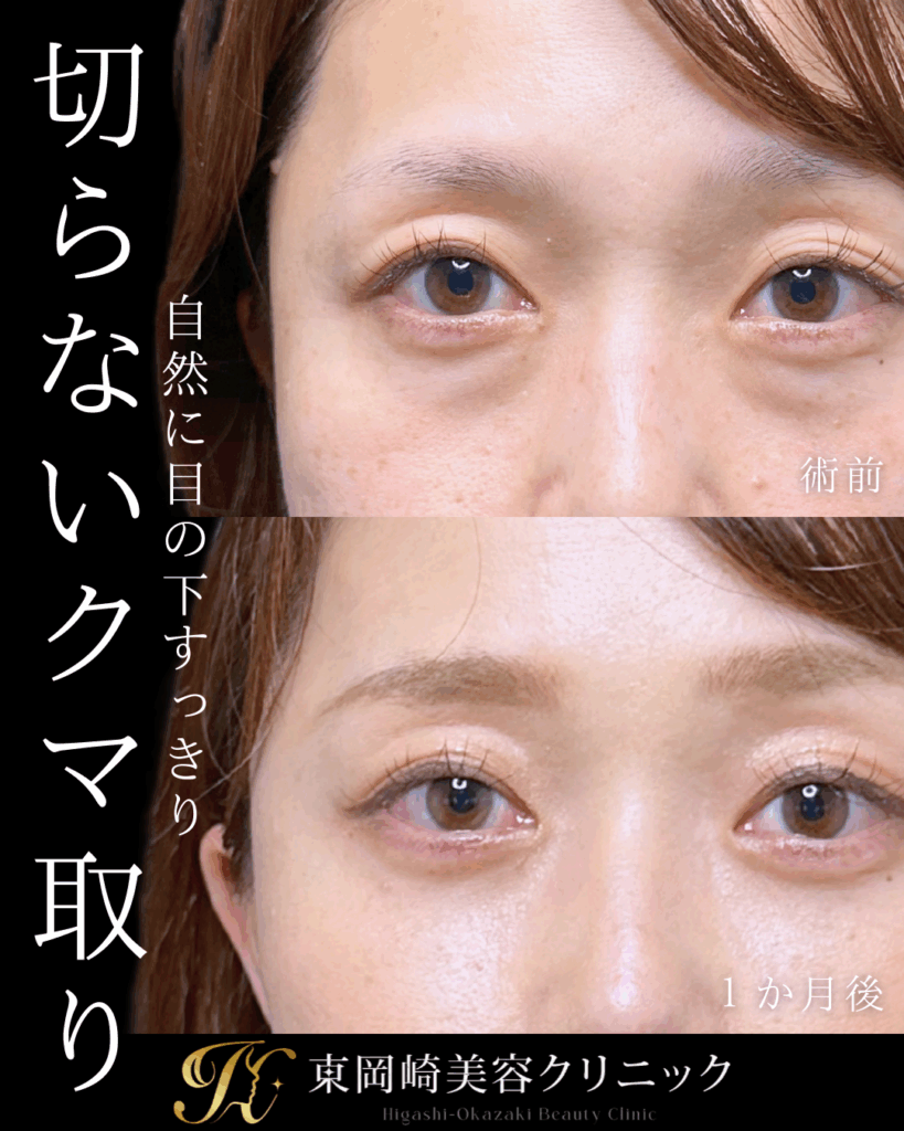 症例イメージ