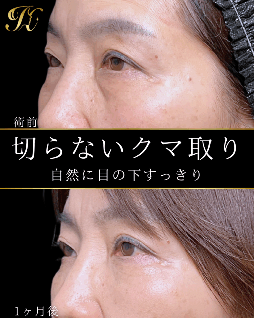 症例イメージ
