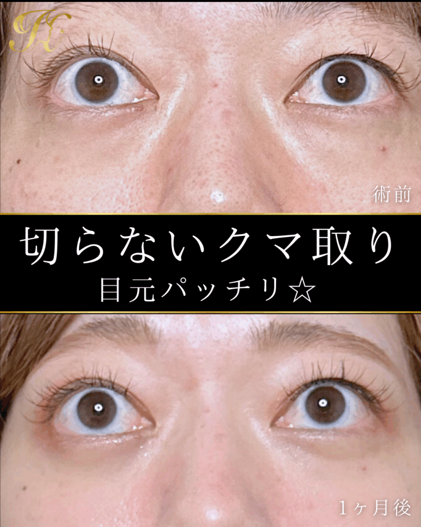 症例イメージ