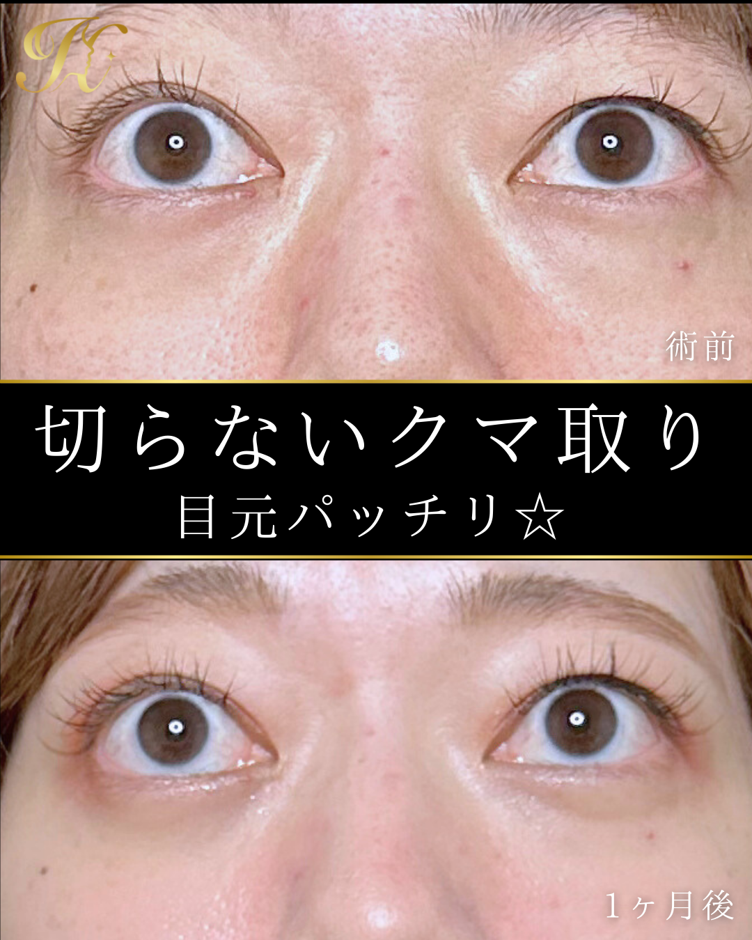 症例イメージ
