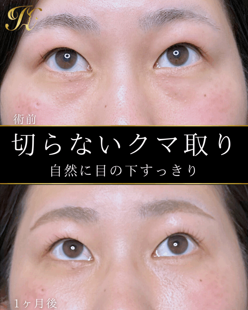 症例イメージ