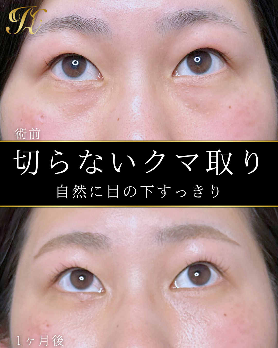 症例イメージ