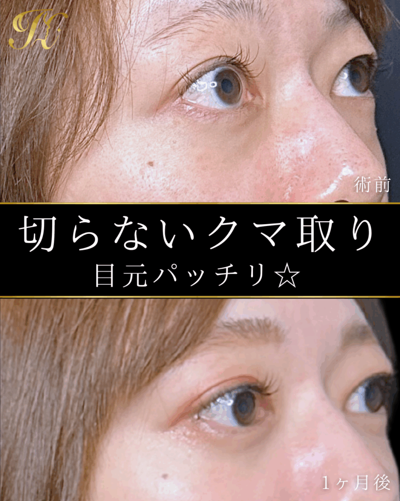 症例イメージ