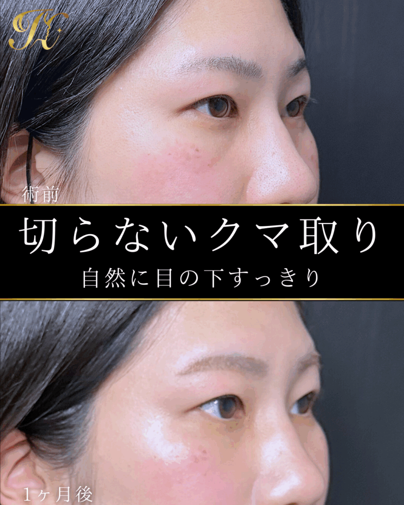 症例イメージ