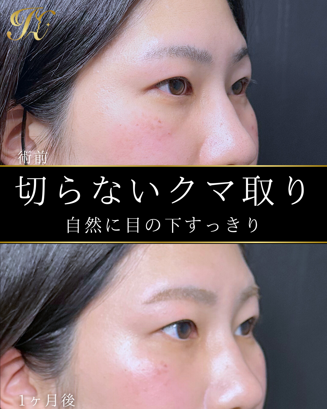 症例イメージ