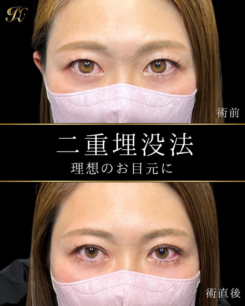 症例イメージ