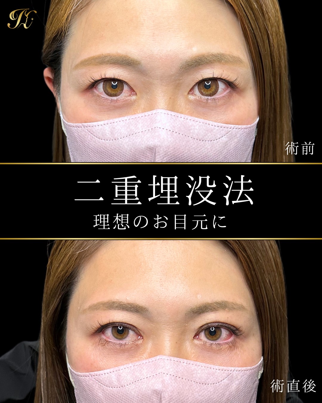 症例イメージ