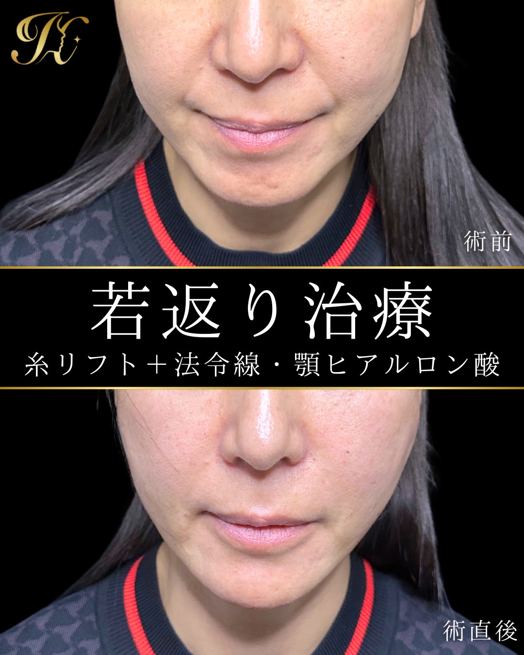 症例イメージ