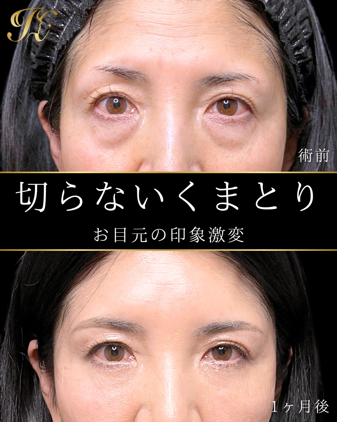 症例イメージ