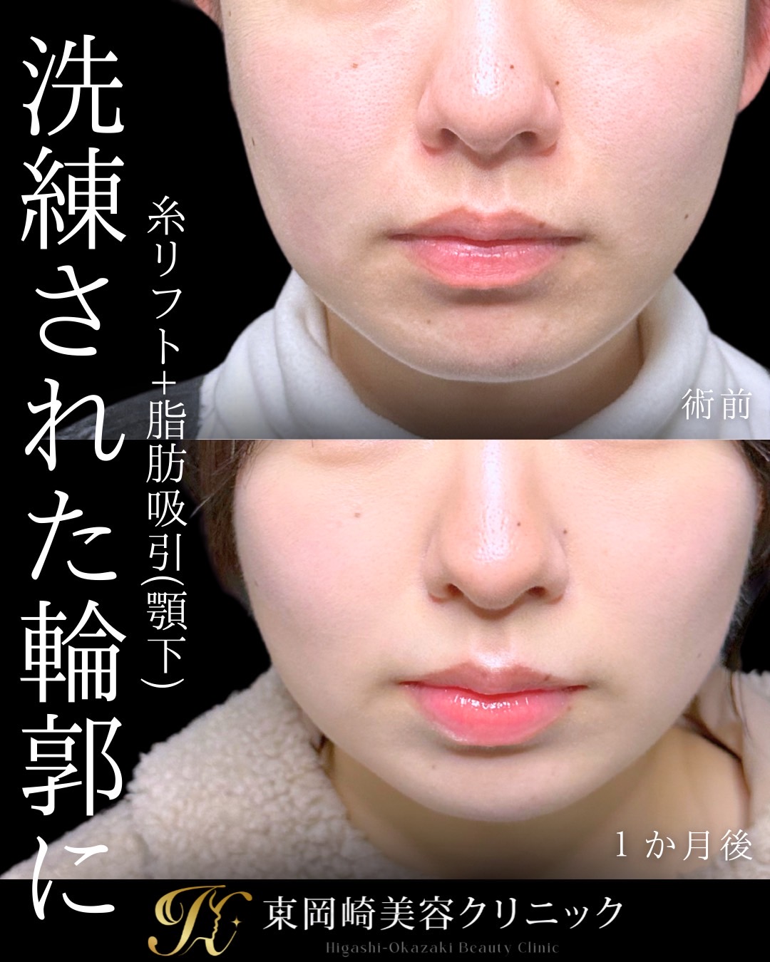 症例イメージ