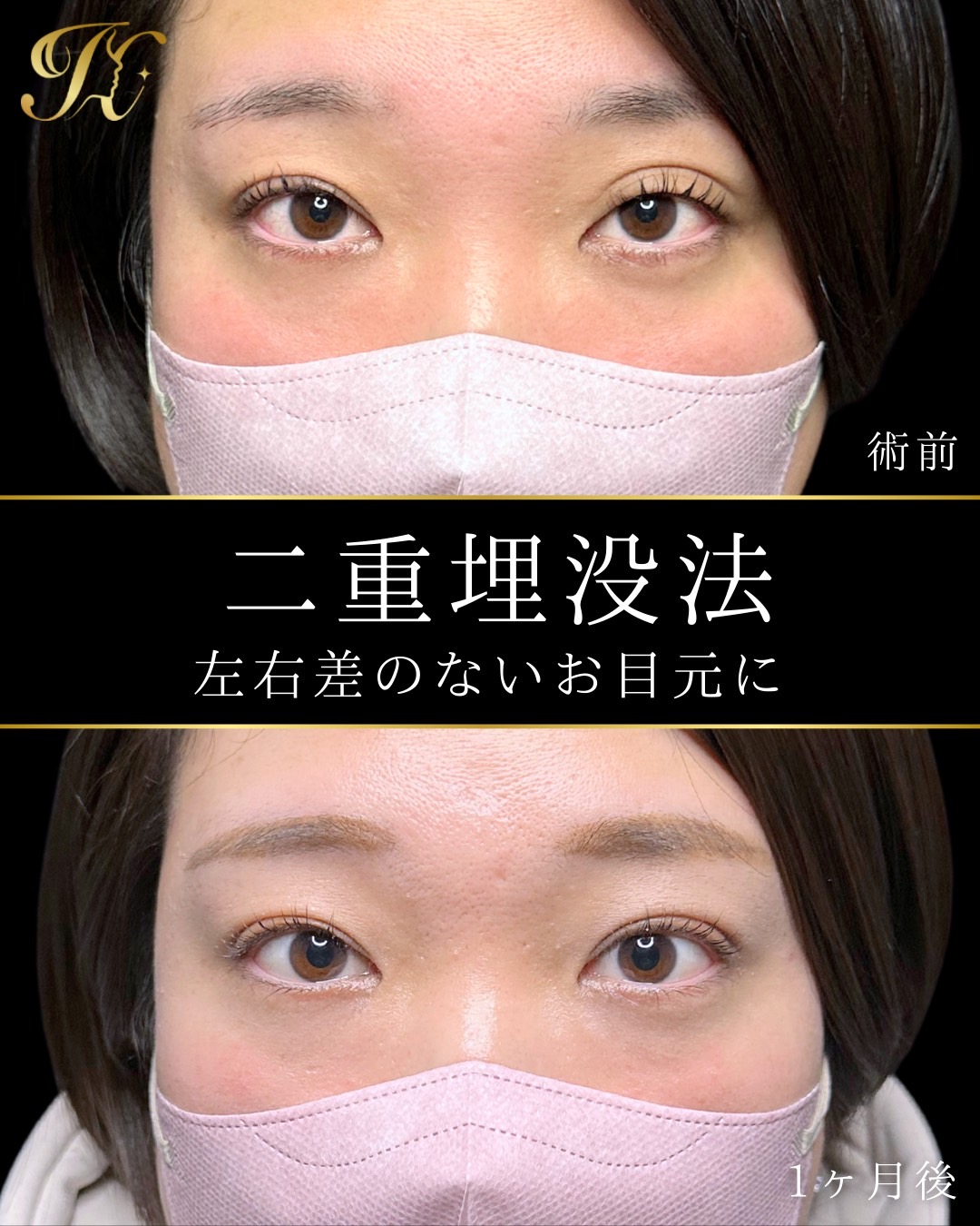 症例イメージ