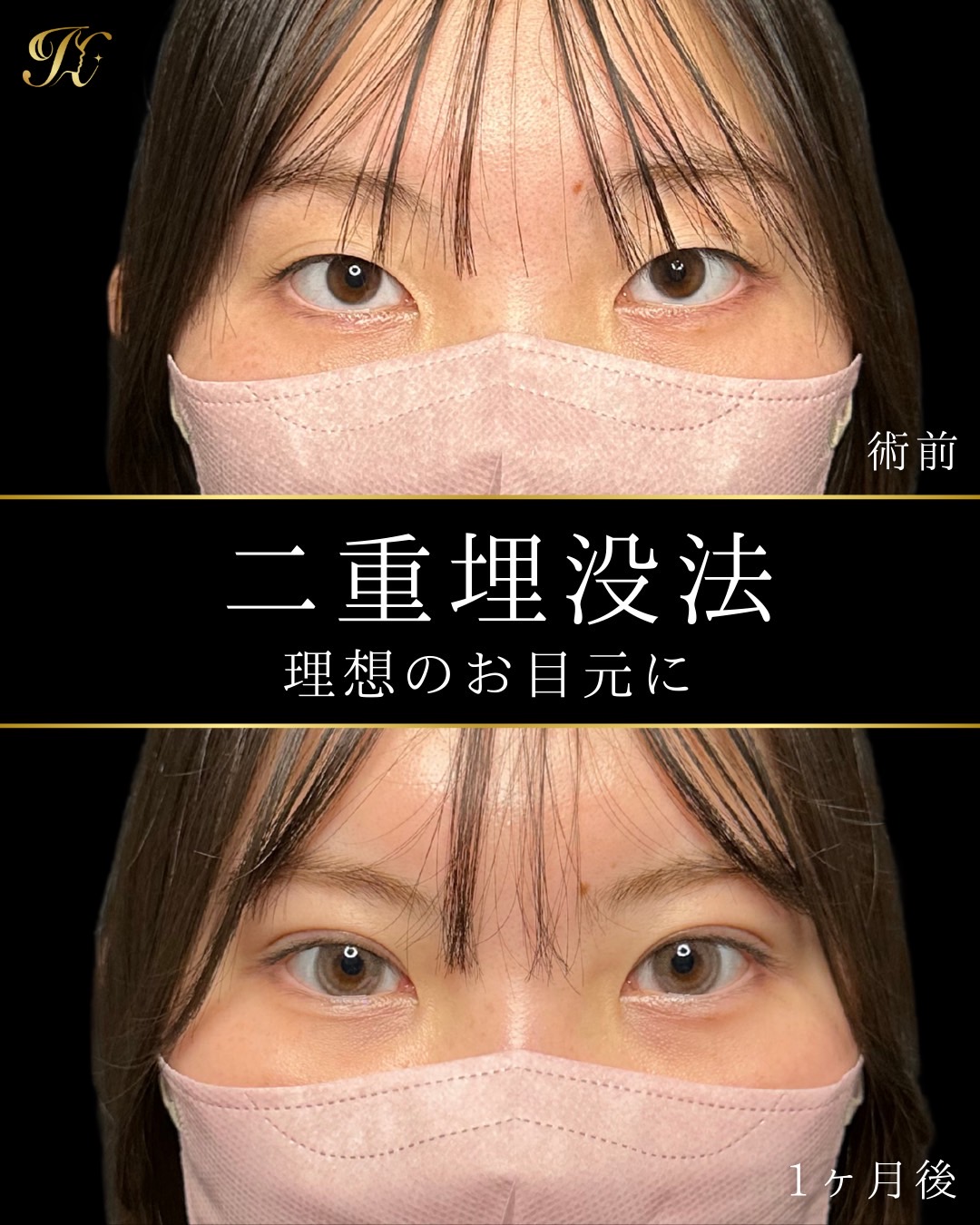 症例イメージ