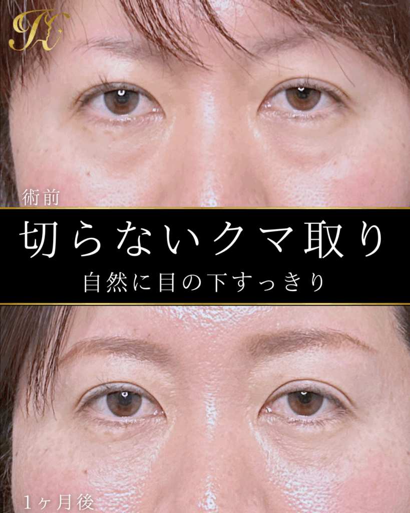 症例イメージ