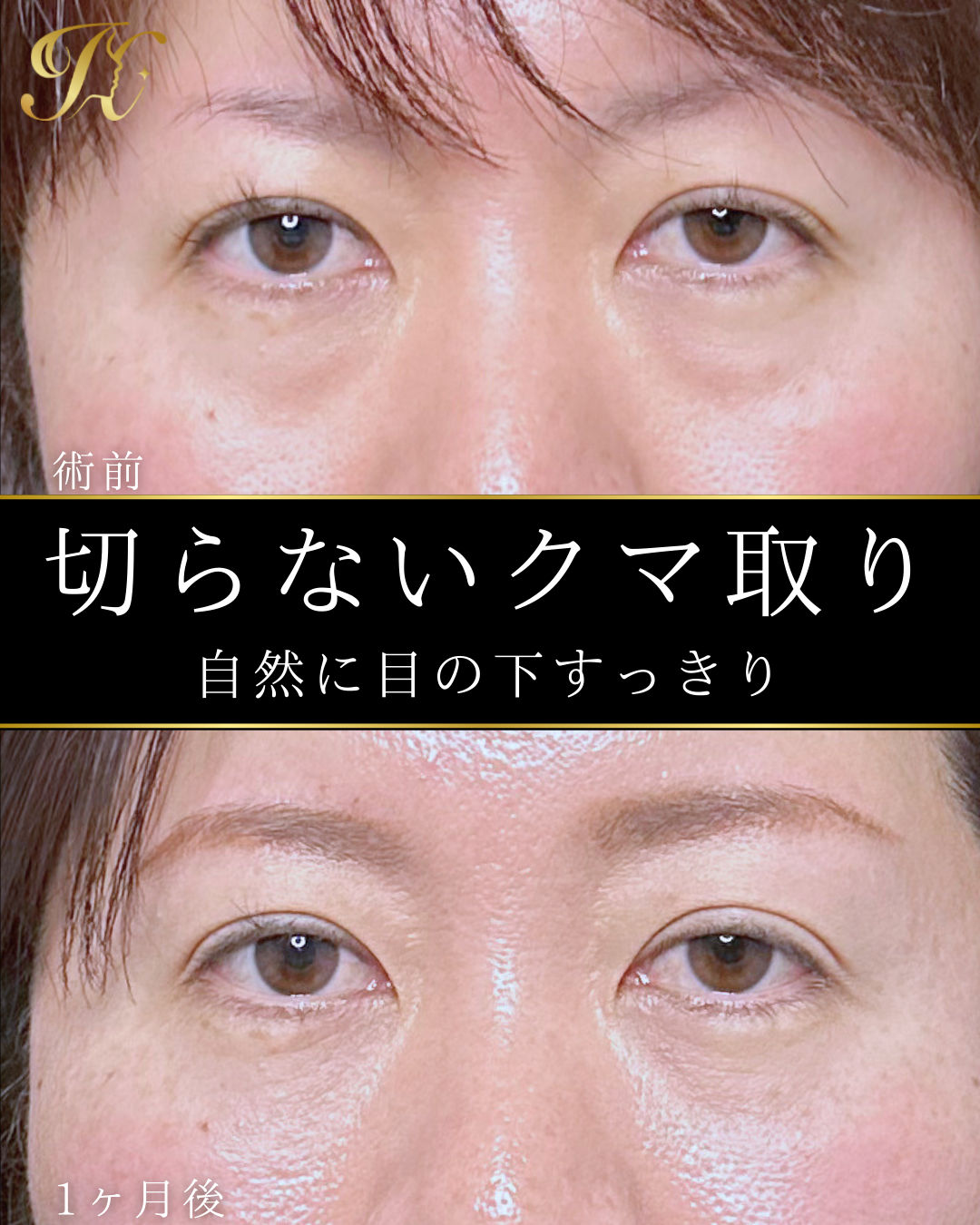 症例イメージ