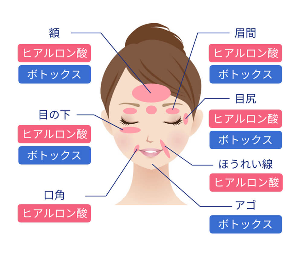 シワの改善