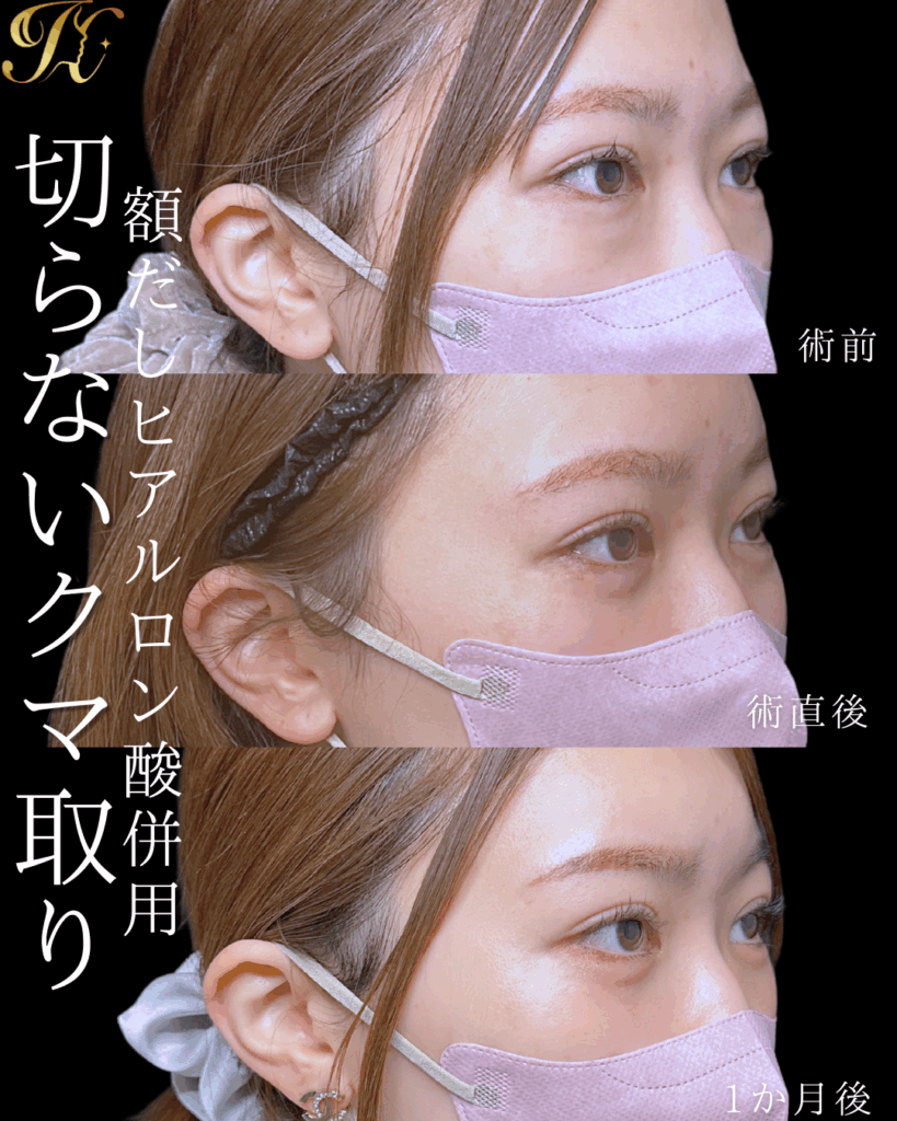 症例イメージ