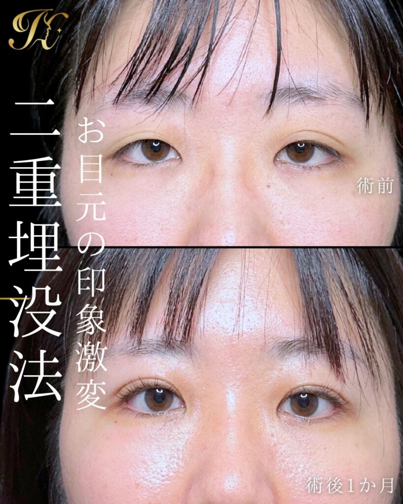 症例イメージ