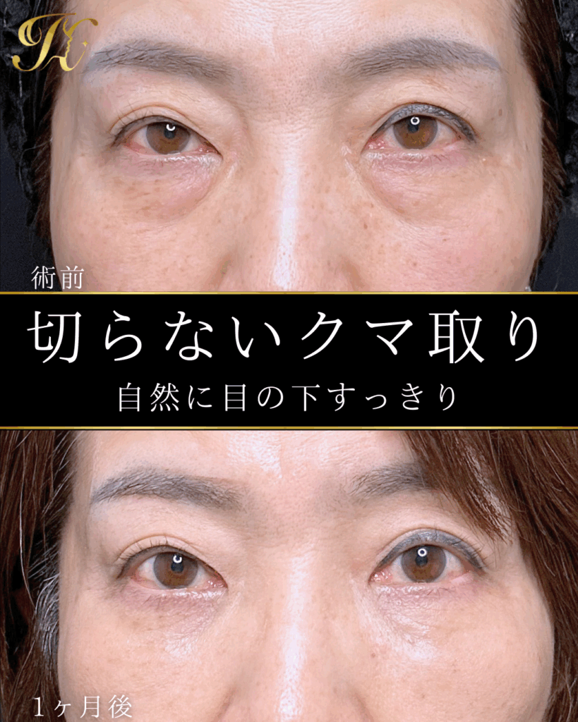 症例イメージ