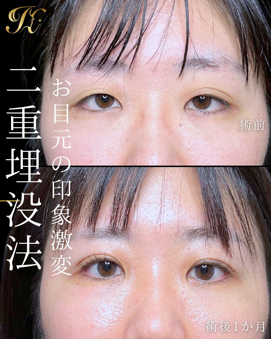 症例イメージ