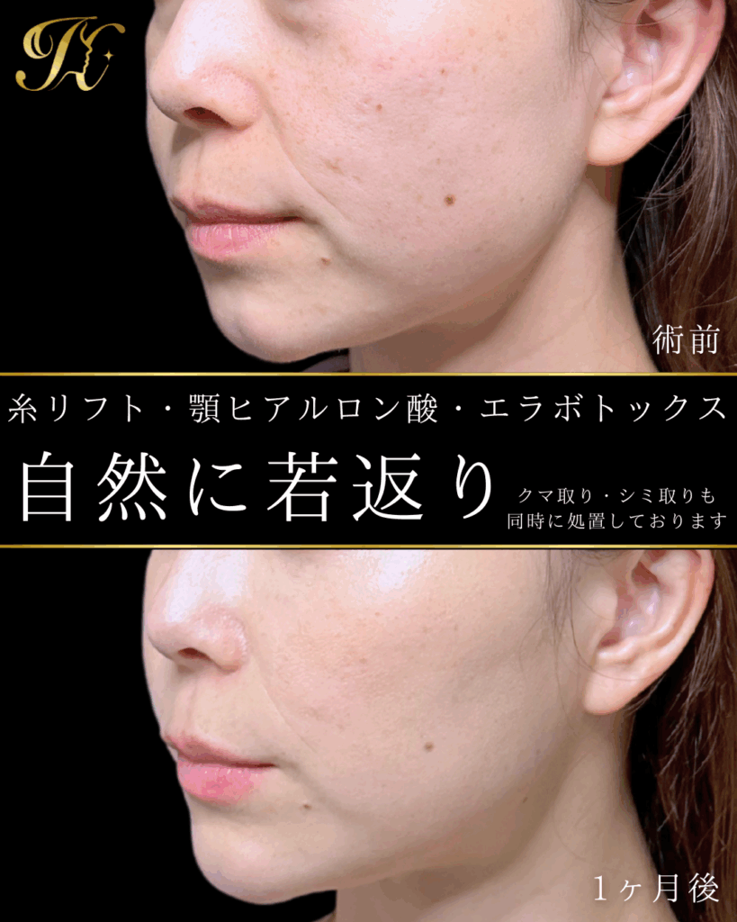 症例イメージ