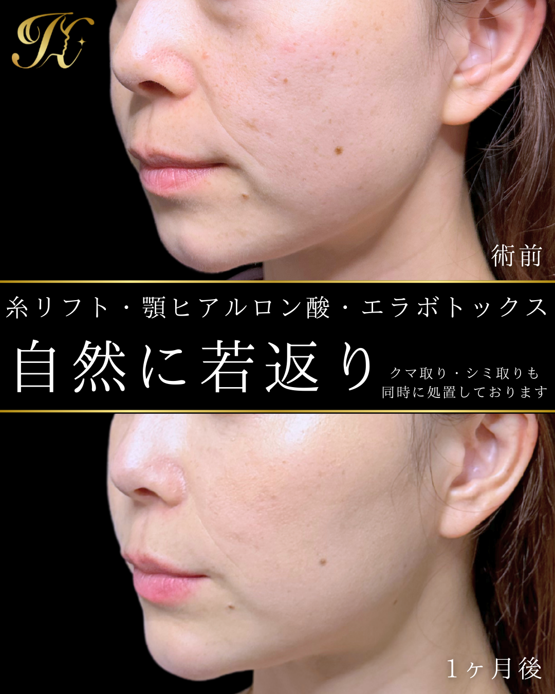 症例イメージ