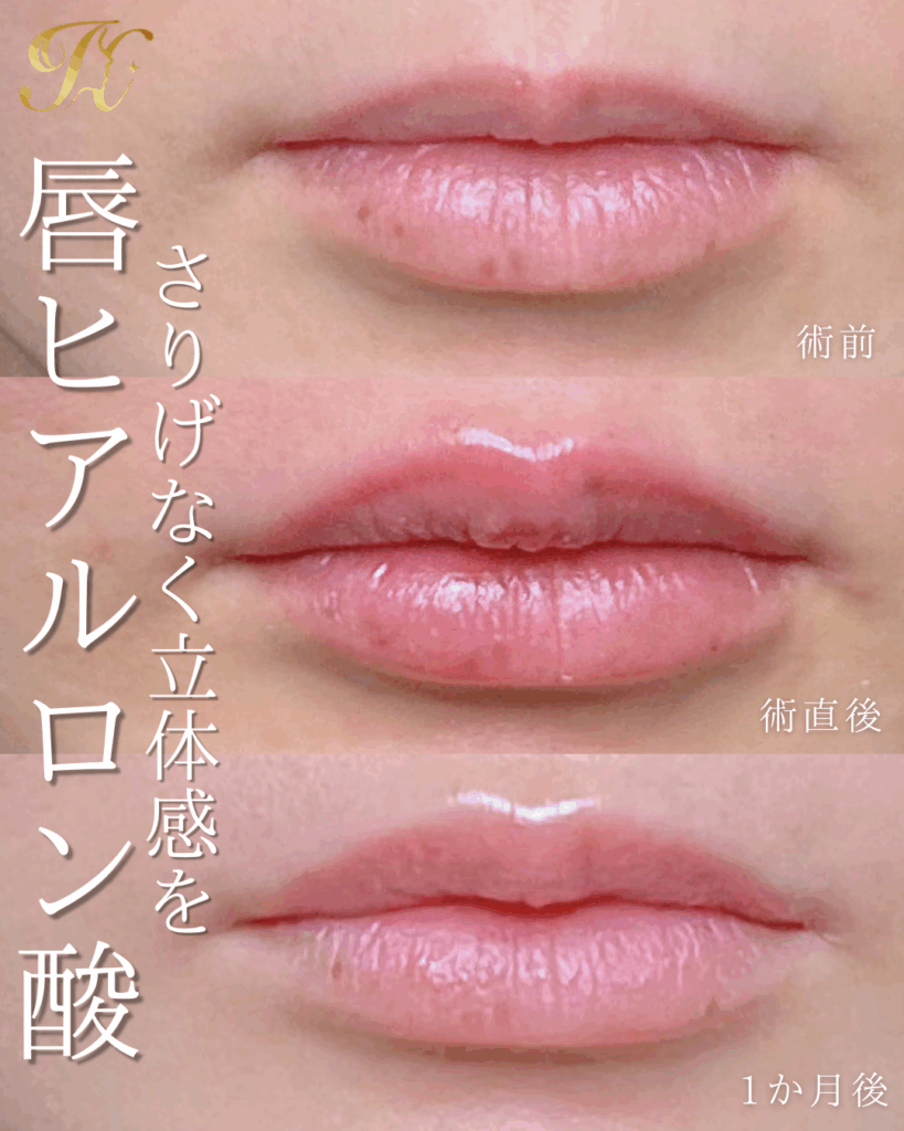 症例イメージ