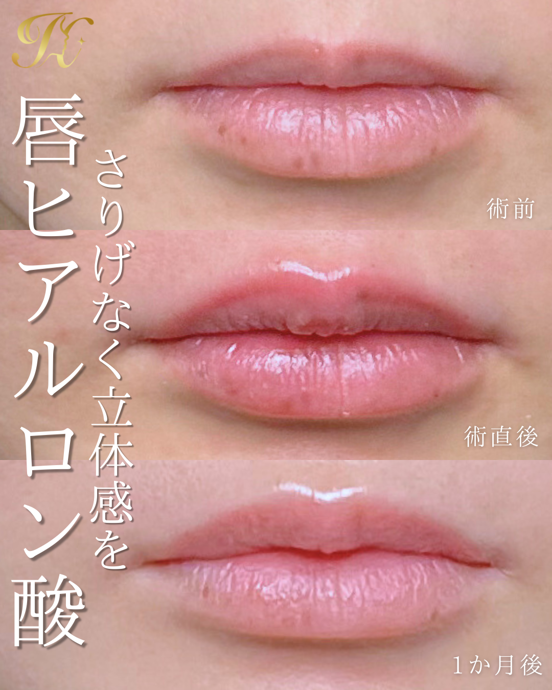 症例イメージ