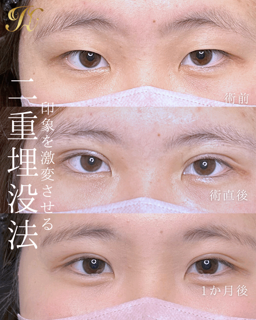 症例イメージ