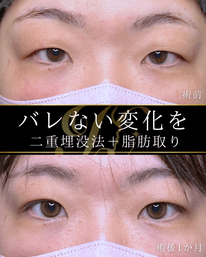 症例イメージ