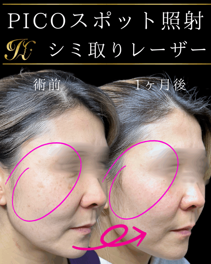 症例イメージ