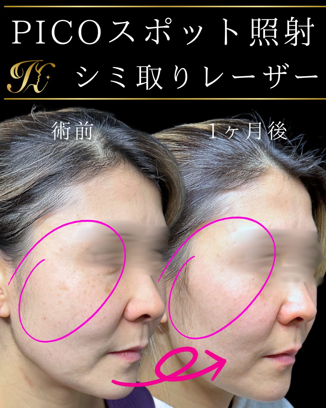 症例イメージ