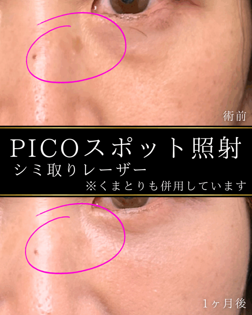 症例イメージ