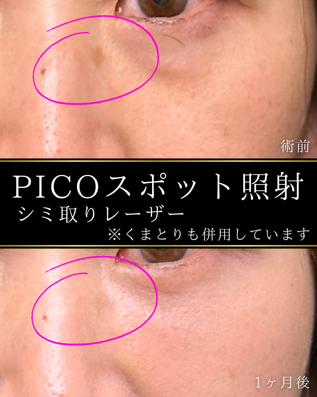 症例イメージ