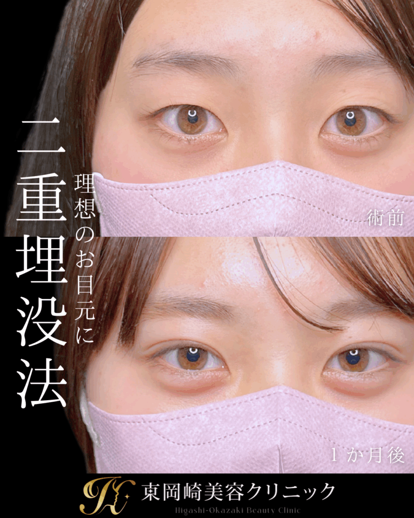 症例イメージ