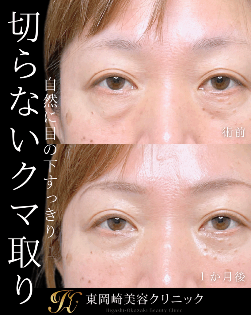 症例イメージ