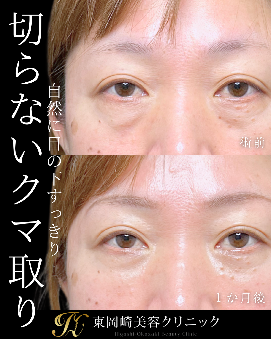 症例イメージ