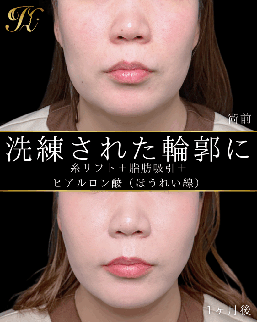 症例イメージ