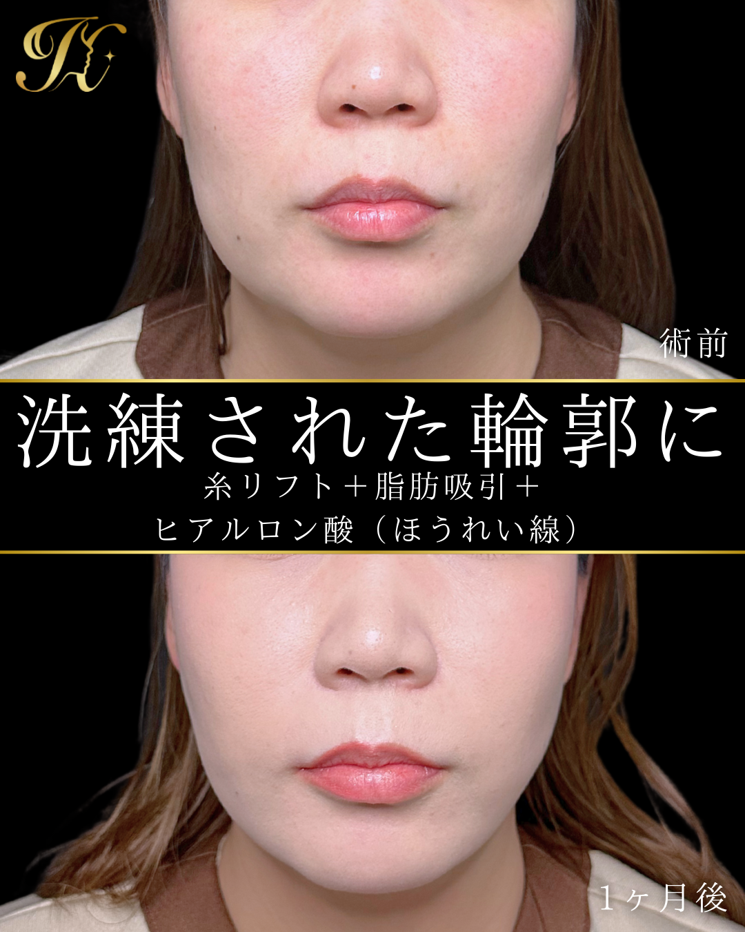 症例イメージ