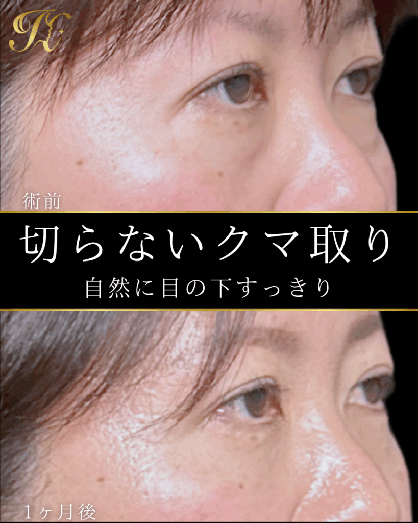 症例イメージ