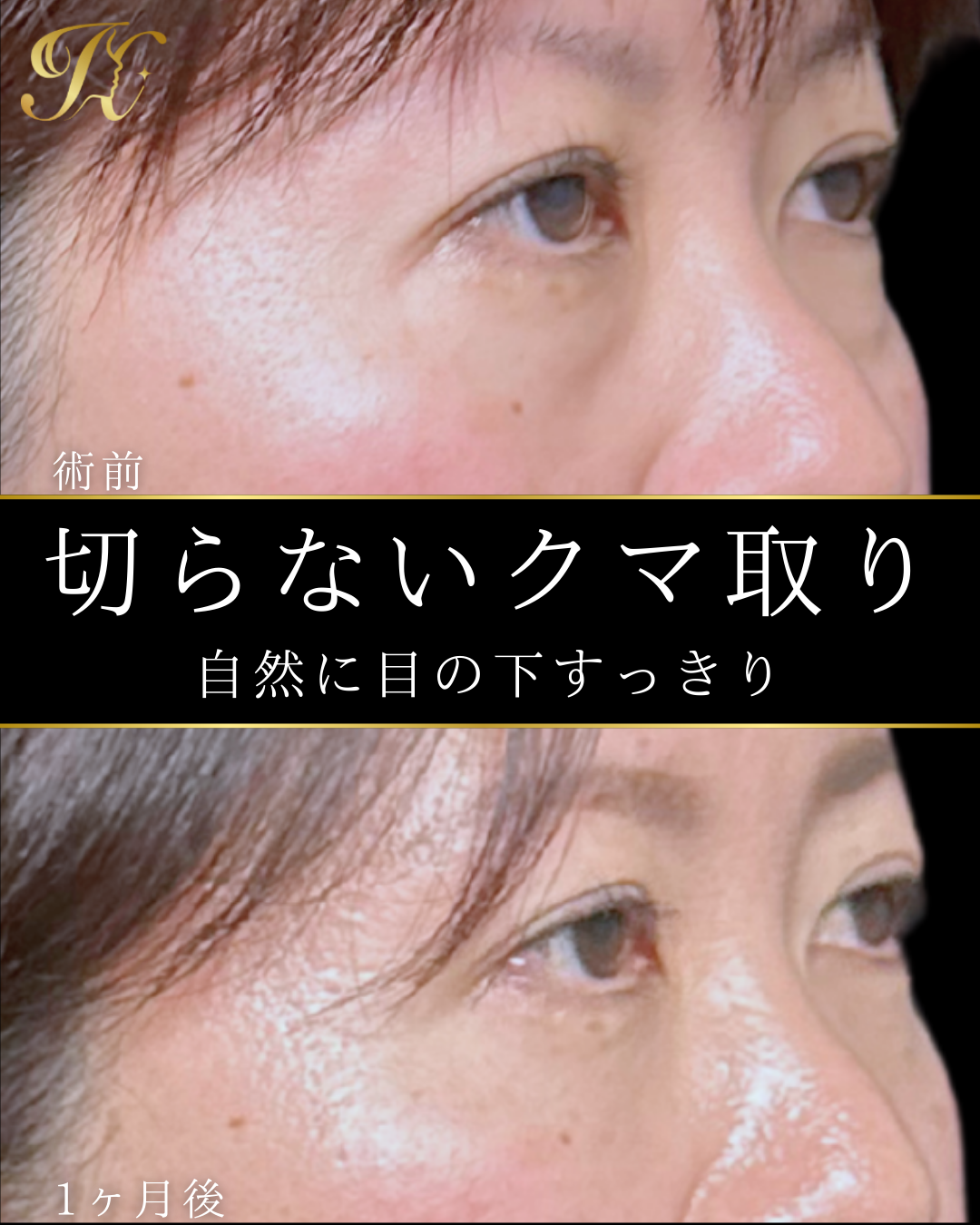 症例イメージ