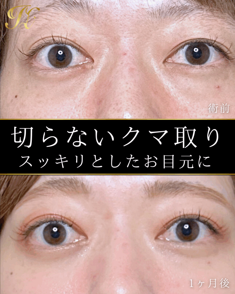 症例イメージ